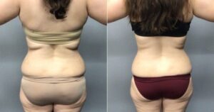 B&A - Lady Back Side