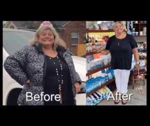 Before After Photos GLP-1 (1)