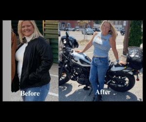 Before After Photos GLP-1 (2)