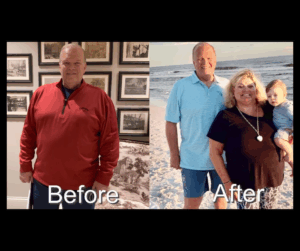 Before After Photos GLP-1 (3)